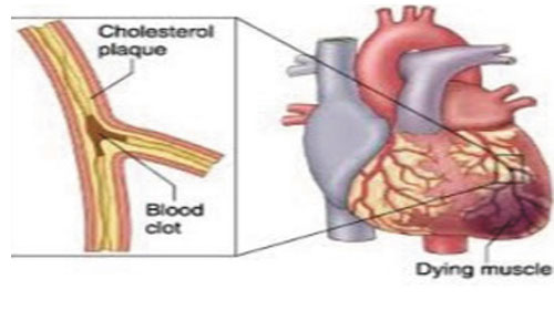 Hệ tim mạch trong tiếng Anh (tiếp)