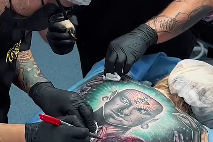 Gây Mê Để Xăm Toàn Thân