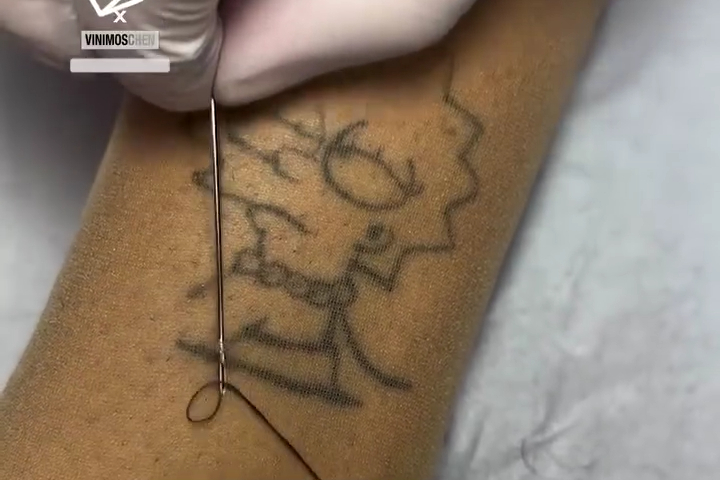 Hình Xăm Khâu Simpsons Ảo Đỉnh Nóc